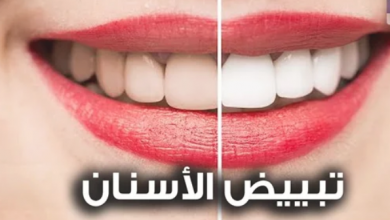 Photo of مفيدة أم ضارة.. حقيقة وصفات تبييض الأسنان