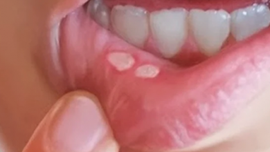 Photo of طرق طبيعية للتخلص من قرح الفم