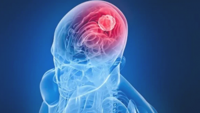 Photo of جراح مخ واعصاب يوضح أعراض الأصابة بالورم الدماغي
