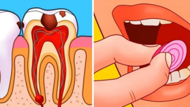 Photo of وصفات طبيعية للتخلص من ألم الأسنان