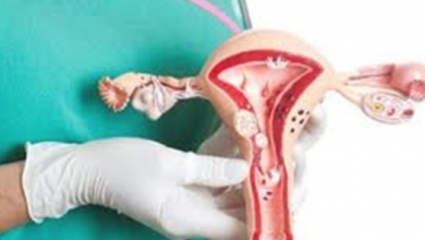Photo of حالات تحتاج فيها النساء إلى ربط عنق الرحم
