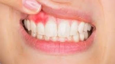 Photo of لا تهملها.. دراسة أمريكية تكشف علاقة التهاب الأسنان بالسرطان