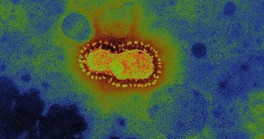 Photo of تسجل 2462 إصابة جديدة بفيروس كورونا خلال 24 ساعة في أوكرانيا