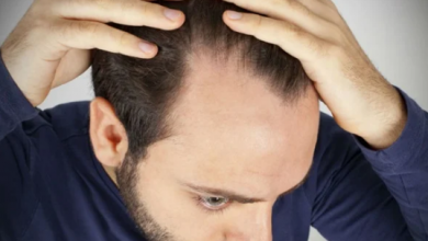 Photo of أفضل علاج لتساقط الشعر عند الرجال
