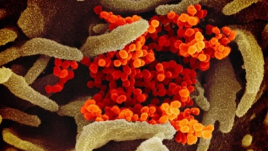Photo of دراسة تكشف علاقة فيروس كورونا باضطرابات المعدة.. تفاصيل