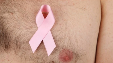 Photo of تفاصيل سرطان الثدي عند الرجال
