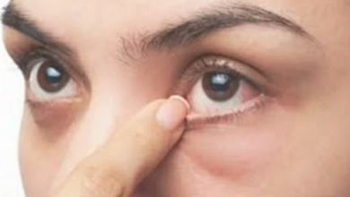 Photo of علاجات منزلية للتخلص من جفاف العين في الشتاء
