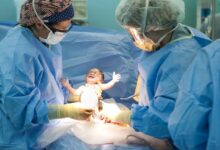 Photo of الصحة : خفض معدلات الولادات القيصرية بمستشفيات الوزارة إلى 61% خلال شهري يناير وفبراير 2023